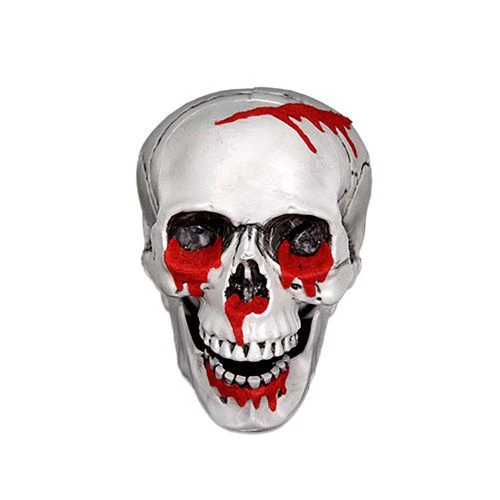 Schedel Bloed 1 Schedel Bloed